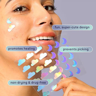 Dream Skin Pimple Patches – Hydrocolloid Formula for Acne, Spots, Redness, and Oiliness