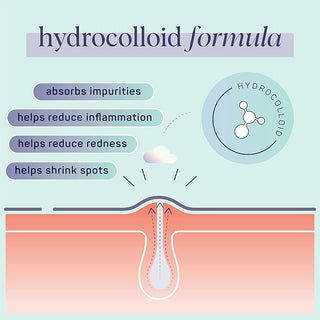 Dream Skin Pimple Patches – Hydrocolloid Formula for Acne, Spots, Redness, and Oiliness